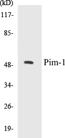 Western blot analysis of extracts from Jurkat cells, using Pim-1 (Ab-309) Antibody.