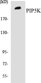 Western blot analysis of extracts from HepG2 cells, using PIP5K Antibody.
