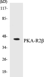 Western blot analysis of extracts from K562/HepG2 cells, using PKA-R2 beta (Ab-113) Antibody.