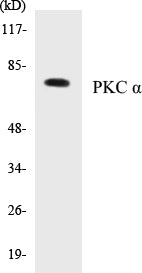 Western blot analysis of extracts from NIH-3T3 cells, treated with UV 15', using PKC alpha (Ab-638) Antibody.