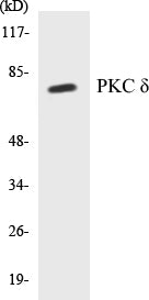 Western blot analysis of extracts from NIH-3T3 cells, treated with UV 15', using PKC delta (Ab-505) Antibody.
