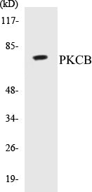 Western blot analysis of extracts from HeLa cells, using PKCB (Ab-661) Antibody.
