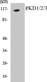 Western blot analysis of extracts from Jurkat cells, using PKD1/2/3/PKC mu (Ab-744/748) Antibody.