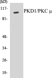 Western blot analysis of extracts from HuvEc cells, treated with PMA 125ng/ml 30', using PKD1/PKC mu (Ab-205) Antibody.
