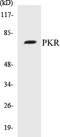 Western blot analysis of extracts from HeLa, using PKR (Ab-446) Antibody.