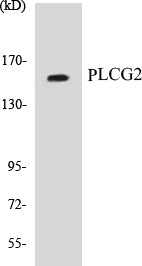 Western blot analysis of extracts from COLO205 cells, using PLCG2 (Ab-753) Antibody.