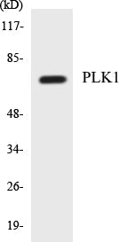 Western blot analysis of extracts from LOVO cells, treated with PMA 125ng/ml 30', using PLK1 (Ab-210) Antibody.
