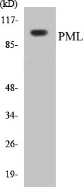 Western blot analysis of extracts from A549 cells, using PML Antibody.