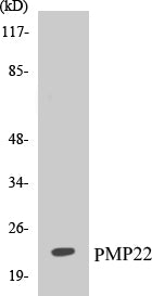 Western blot analysis of extracts from MDA-MB-435 cells, using PMP22 Antibody.