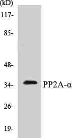 Western blot analysis of extracts from A549 cells, using PP2A-alpha (Ab-307) Antibody.