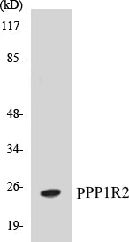Western blot analysis of extracts from Jurkat cells, using PPP1R2 (Ab-120/121) Antibody.