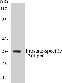 Western blot analysis of extracts from mouse heart cells, using Prostate-specific Antigen Antibody.