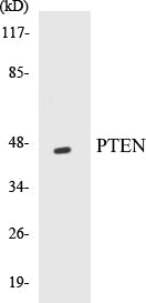 Western blot analysis of extracts from HeLa cells, treated with Vanadate, using PTEN (Ab-370) Antibody.