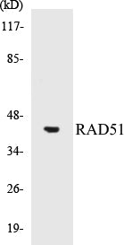 Western blot analysis of extracts from LOVO cells, using RAD51 (Ab-315) Antibody.