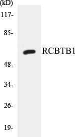 Western blot analysis of extracts from LOVO cells, using RCBTB1 Antibody.