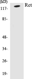 Western blot analysis of extracts from Jurkat cells, using Ret (Ab-905) Antibody.