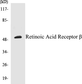 Western blot analysis of extracts from HepG2 cells, using Retinoic Acid Receptor beta Antibody.