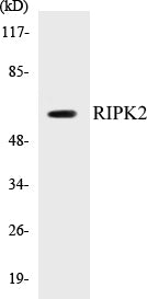 Western blot analysis of extracts from rat brain cells, using RIPK2 (Ab-176) Antibody.