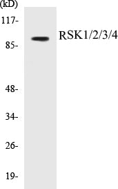 Western blot analysis of extracts from Jurkat cells, using RSK1/2/3/4 (Ab-221/227/S218/232) Antibody.