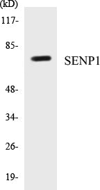 Western blot analysis of extracts from Jurkat cells, using SENP1 Antibody.