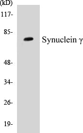 Western blot analysis of extracts from MDA-MB-435 cells, using SENP2 Antibody.