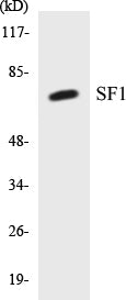 Western blot analysis of extracts from COLO205 cells, using SF1 (Ab-82) Antibody.