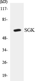 Western blot analysis of extracts from Jurkat/COLO205 cells, using SGK (Ab-422) Antibody.