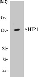 Western blot analysis of extracts from mouse brain cells, using SHIP1 (Ab-1020) Antibody.
