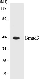 Western blot analysis of extracts from HuvEc cells, using Smad3 (Ab-204) Antibody.