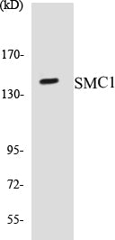 Western blot analysis of extracts from 293 cells, treated with UV 15', using SMC1 (Ab-957) Antibody.