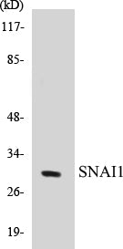 Western blot analysis of extracts from HT29 cells, using SNAI1 (Ab-246) Antibody.