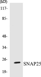 Western blot analysis of extracts from Raw264.7 cells, treated with EGF 200ng/ml 30', using SNAP25 Antibody.