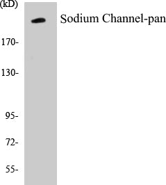 Western blot analysis of extracts from HuvEc cells, using Sodium Channel-pan Antibody.
