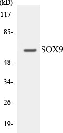 Western blot analysis of extracts from 293 cells, treated with PBS 60', using SOX9 (Ab-181) Antibody.