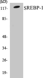 Western blot analysis of extracts from Jurkat cells, treated with TNF 20ng/ml 30', using SREBP-1 (Ab-439) Antibody.