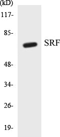 Western blot analysis of extracts from NIH-3T3 cells, treated with PMA 125ng/ml 30', using SRF (Ab-99) Antibody.