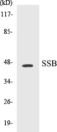 Western blot analysis of extracts from COLO cells, using SSB (Ab-366) Antibody.