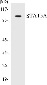 Western blot analysis of extracts from 293/Jurkat/HeLa cells, treated with PMA 125ng/ml 30', using STAT5A (Ab-780) Antibody.
