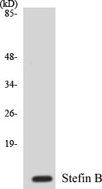 Western blot analysis of extracts from A549 cells, using Stefin B Antibody.