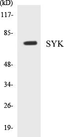 Western blot analysis of extracts from Jurkat cells, treated with UV 15', using SYK (Ab-348) Antibody.
