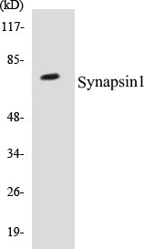 Western blot analysis of extracts from NIH-3T3 cells, treated with Nocodazole 1ug/ml 16h, using Synapsin1 (Ab-62) Antibody.