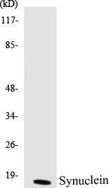 Western blot analysis of extracts from HuvEc cells, using Synuclein (Ab-129) Antibody.