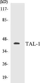 Western blot analysis of extracts from Jurkat cells, treated with PMA 125ng/ml 30', using TAL-1 (Ab-122) Antibody.