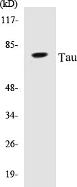 Western blot analysis of extracts from HeLa cells, using Tau (Ab-214) Antibody.