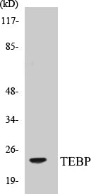 Western blot analysis of extracts from NIH-3T3 cells, treated with EGF 200ng/ml 30', using TEBP (Ab-113) Antibody.