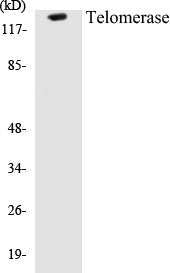 Western blot analysis of extracts from Jurkat cells, using Telomerase (Ab-824) Antibody.