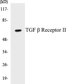 Western blot analysis of extracts from NIH-3T3 cells, using TGF beta Receptor II (Ab-250) Antibody.