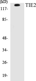 Western blot analysis of extracts from JurKat cells, using Chk1 (Ab-280) Antibody.
