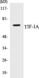 Western blot analysis of extracts from HeLa cells, treated with calyculinA 50ng/ml 30', using TIF-IA (Ab-649) Antibody.