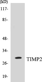 Western blot analysis of extracts from A549 cells, using TIMP2 Antibody.
